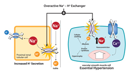 Overactive Na+ - H+ exchanger